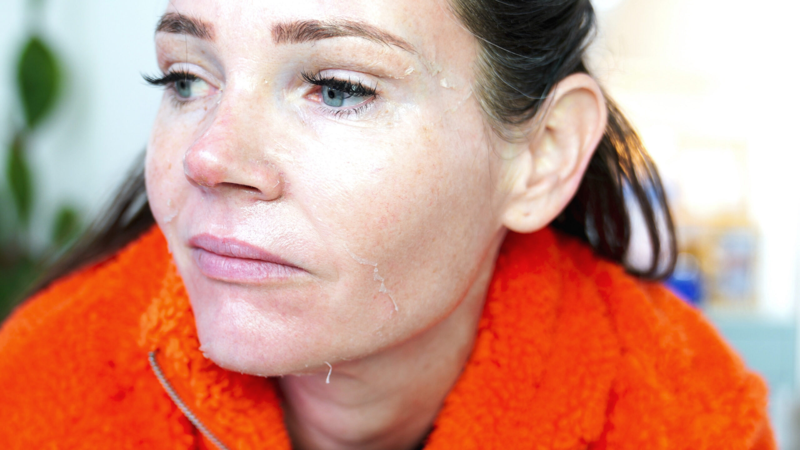 DIY TCA 30% + 5% Salicylic Peel - treatment image