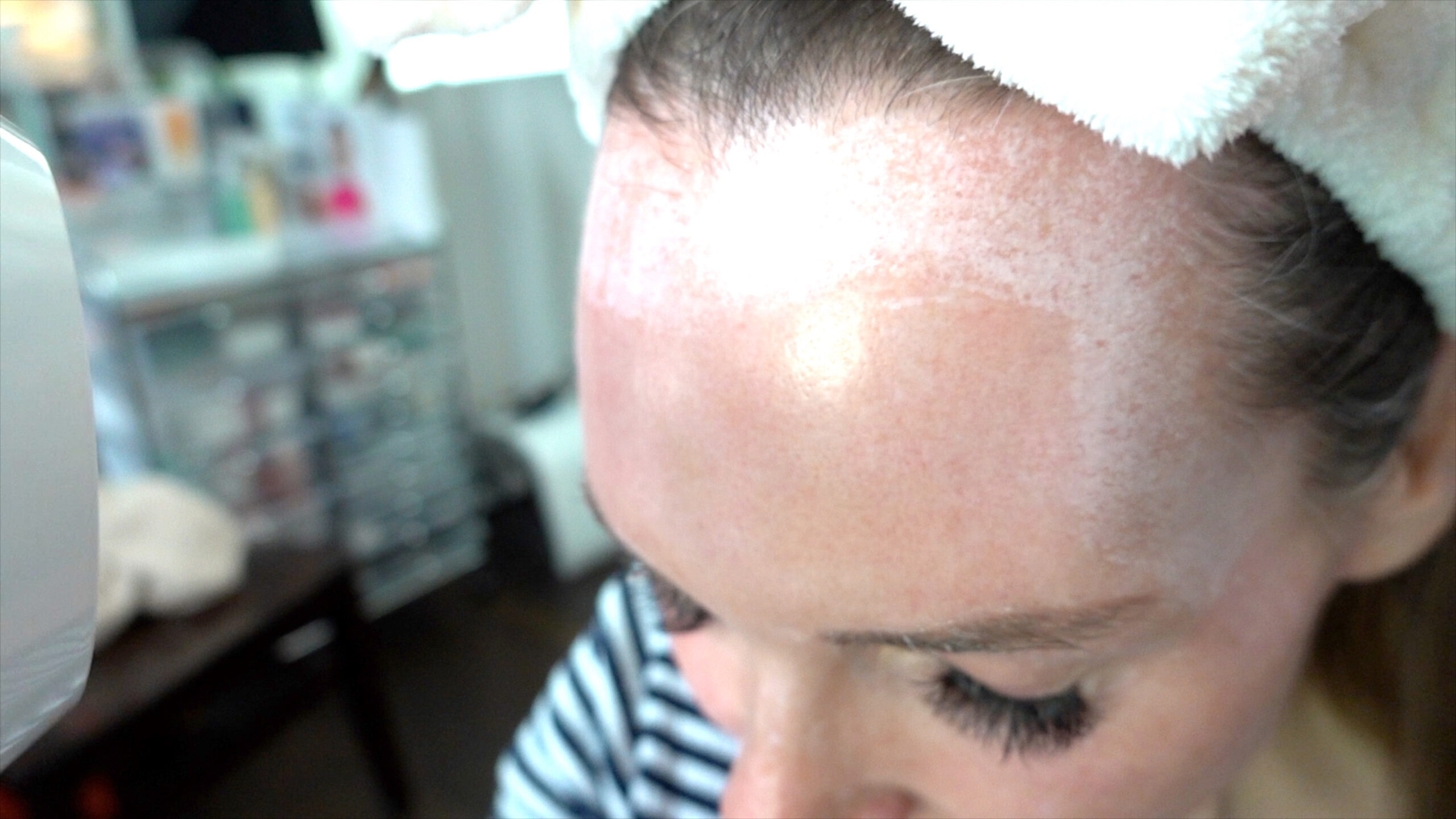 DIY TCA 30% + 5% Salicylic Peel - treatment image