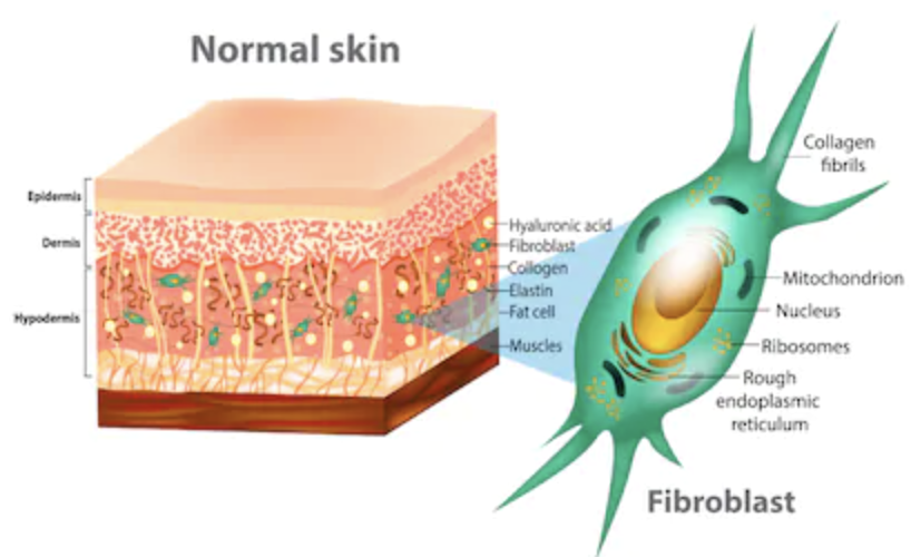 PLASMA FIBROBLAST 101 - treatment image