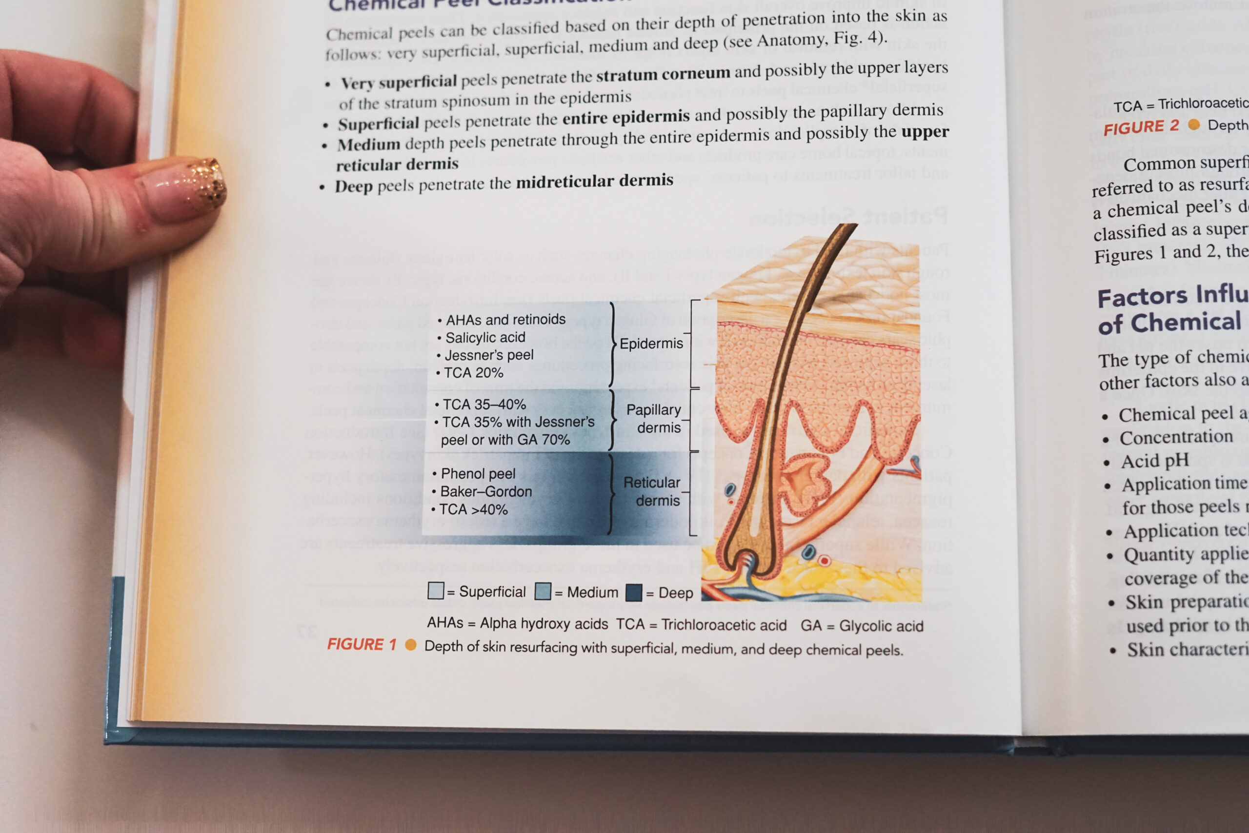 CHEMICAL PEELS 101: Acid Types - treatment image