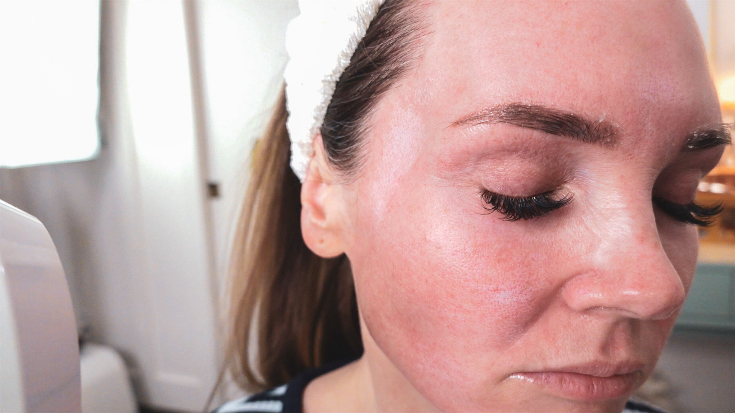 DIY TCA 30% + 5% Salicylic Peel - treatment image