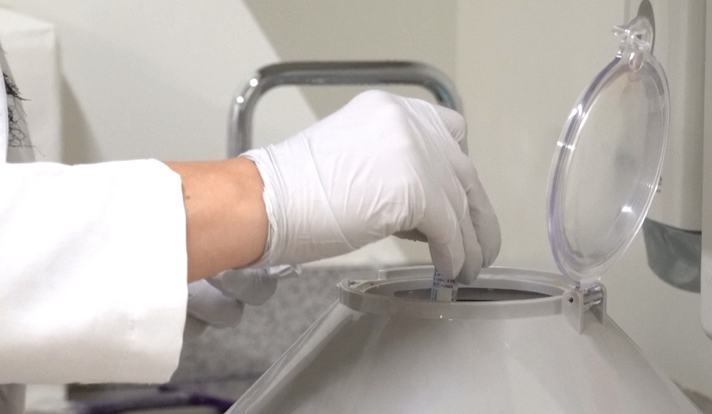 PRP Skin Rejuvenation Treatment - treatment image