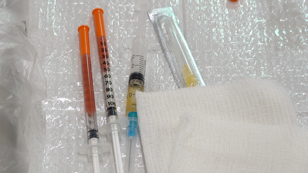 PRP Skin Rejuvenation Treatment - treatment image