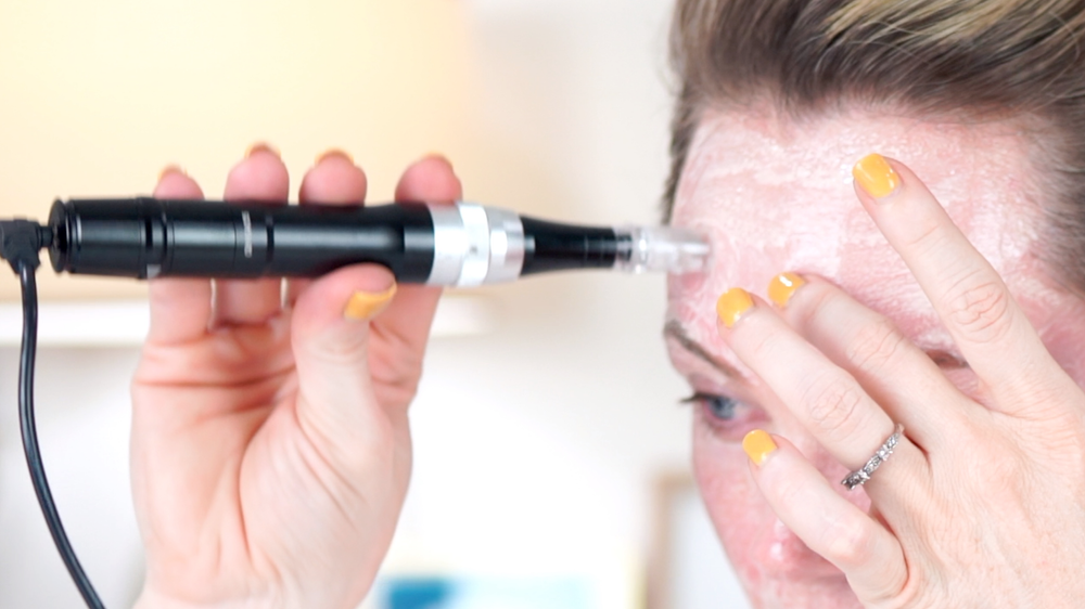 MESOSYS Age Return Carboxy Mask: Mesotherapy Treatment - treatment image