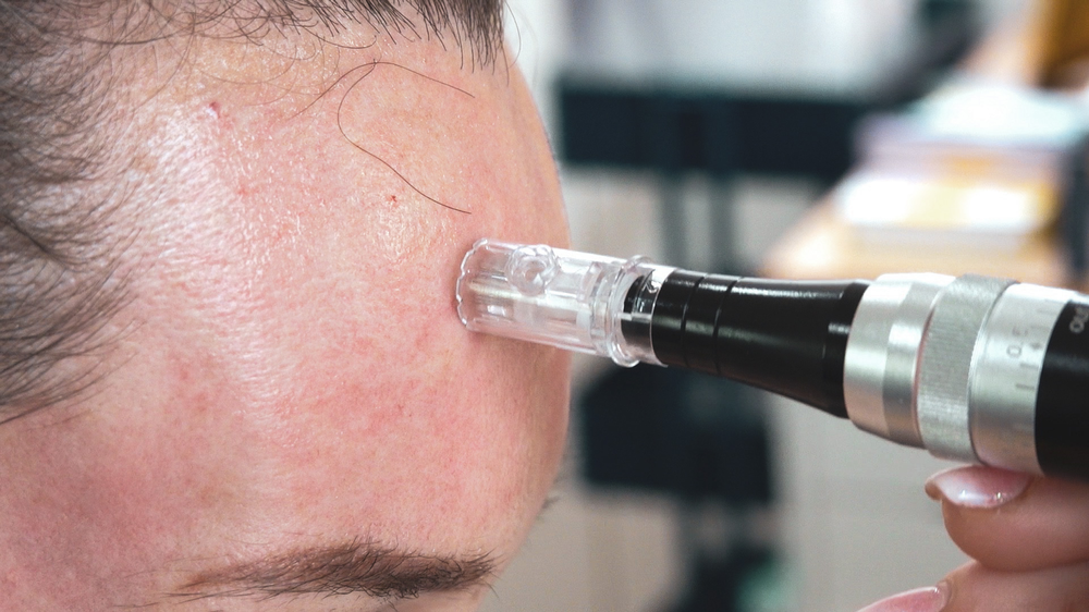 MESOSYS Age Return Carboxy Mask: Mesotherapy Treatment - treatment image