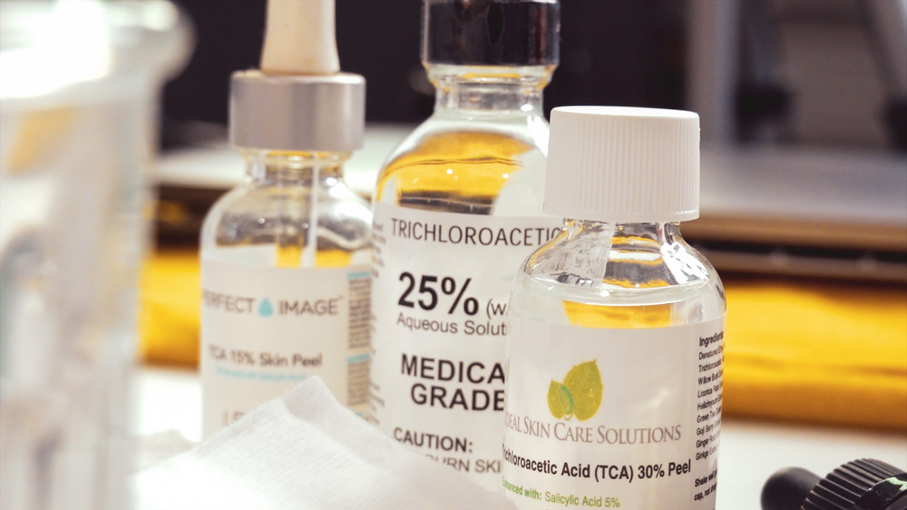 DIY TCA 30% + 5% Salicylic Peel - treatment image