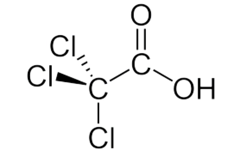 CHEMICAL PEELS 101: Acid Types - treatment image