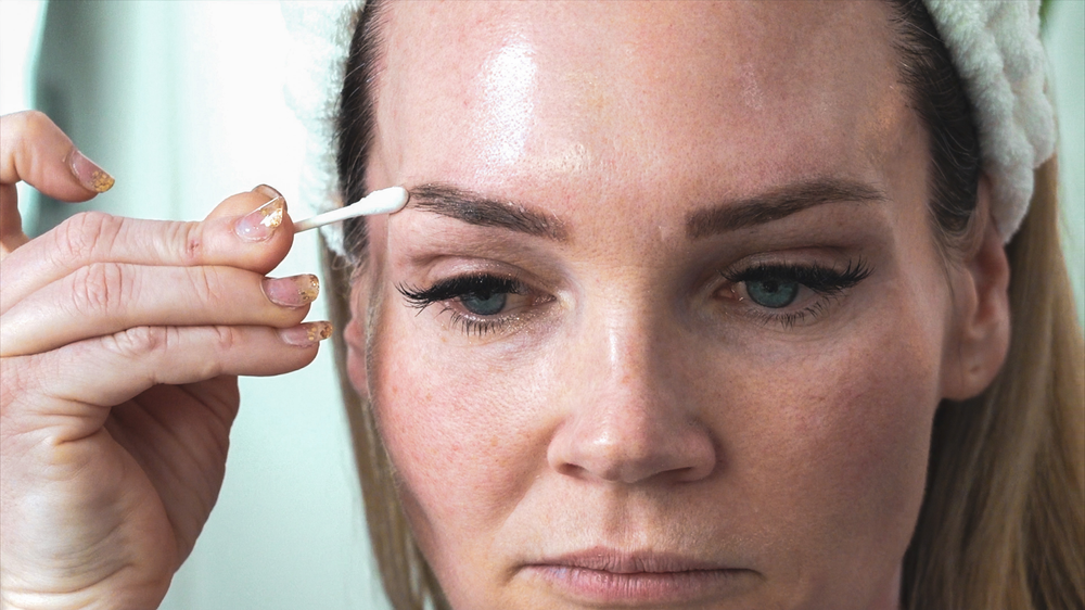 DIY TCA 30% + 5% Salicylic Peel - treatment image