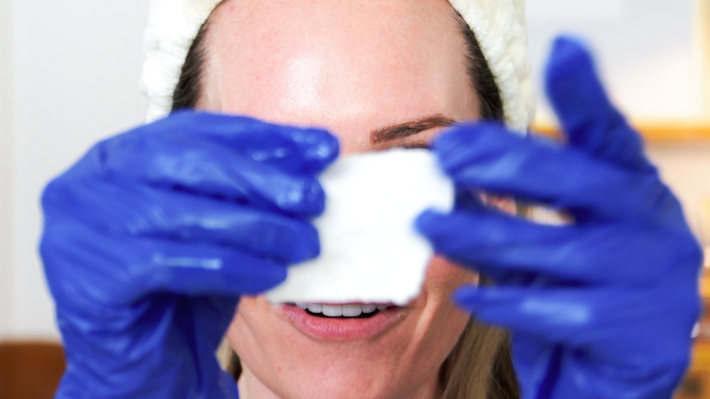 DIY TCA 30% + 5% Salicylic Peel - treatment image