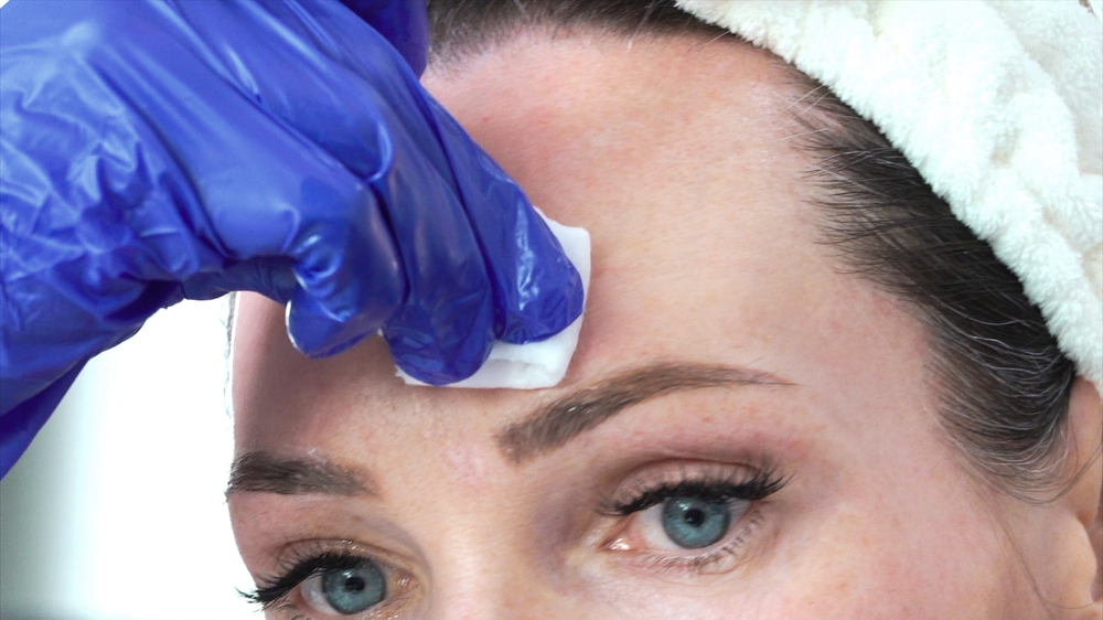 DIY TCA 30% + 5% Salicylic Peel - treatment image