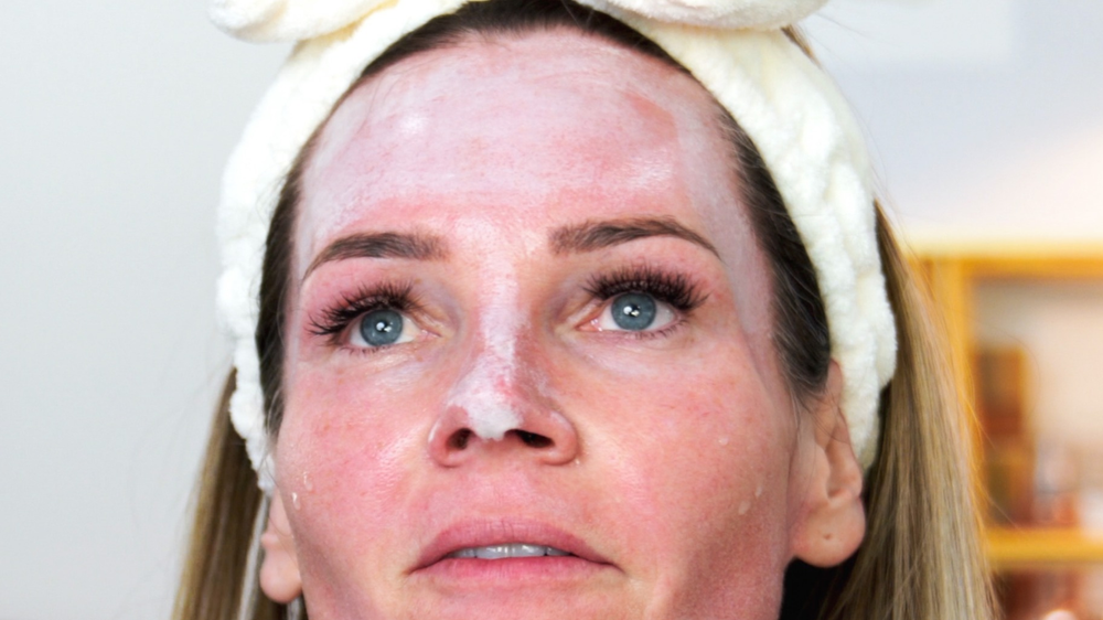 Natural Kaos TCA 30% + 5% SA Frost Natural Kaos TCA 30% + 5% SA Frost Chemical Acid Peel