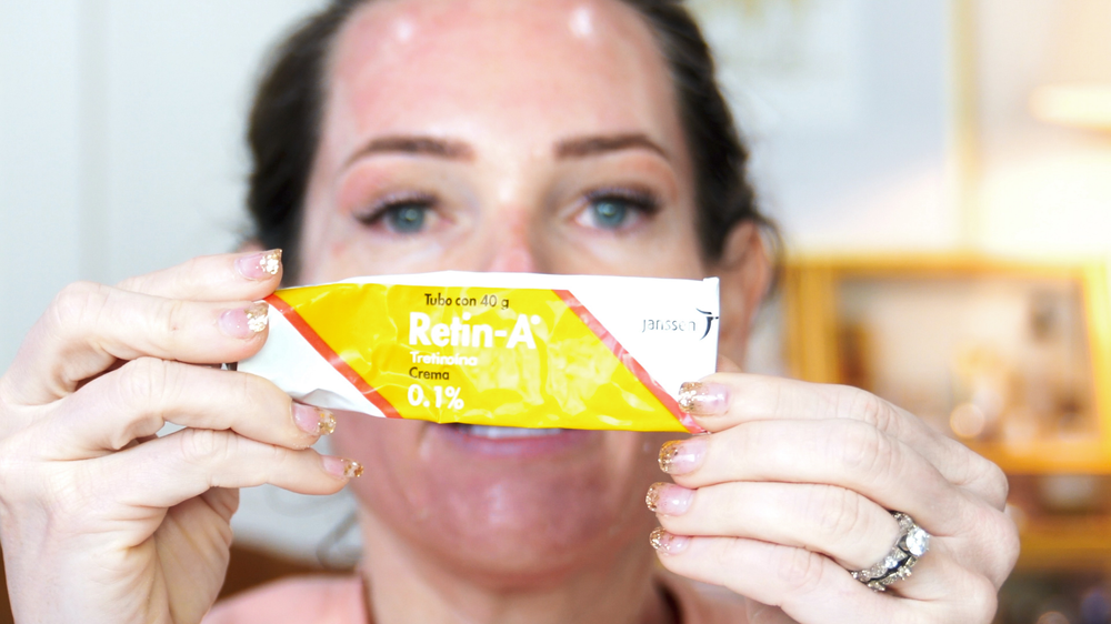 DIY TCA 30% + 5% Salicylic Peel - treatment image