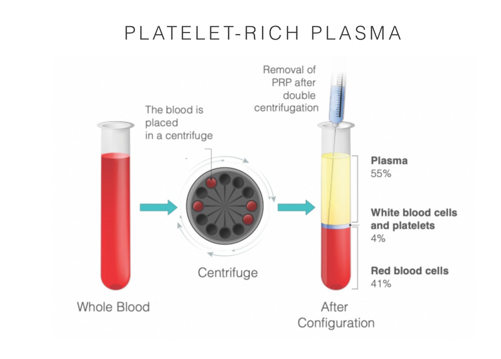 PRP Skin Rejuvenation Treatment - treatment image