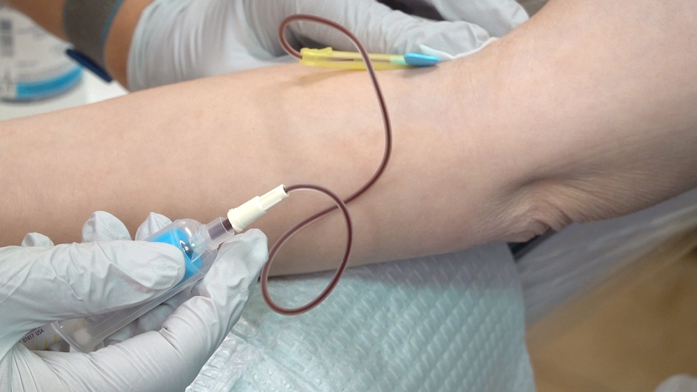 PRP Skin Rejuvenation Treatment - treatment image