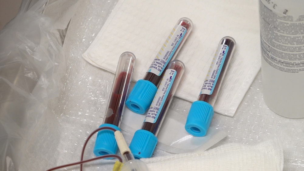 PRP Skin Rejuvenation Treatment - treatment image