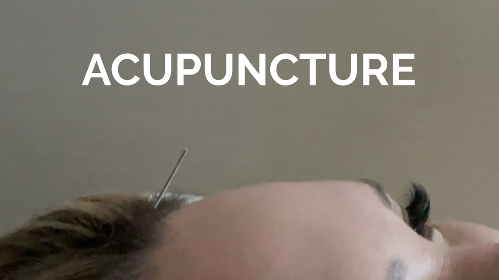 Natural Kaos Acupuncture at Sanctuary Spa