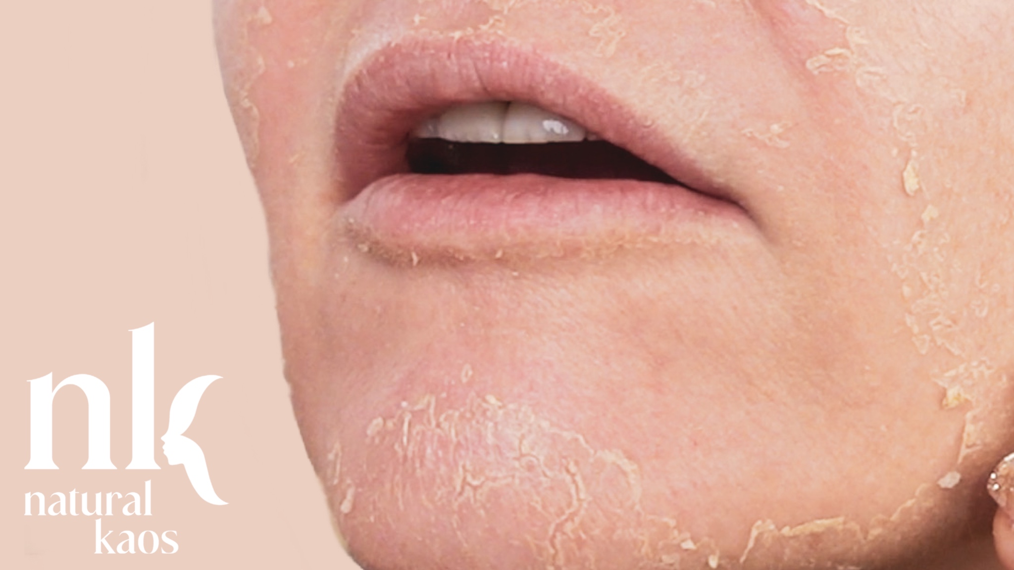 Red Carpet Peel