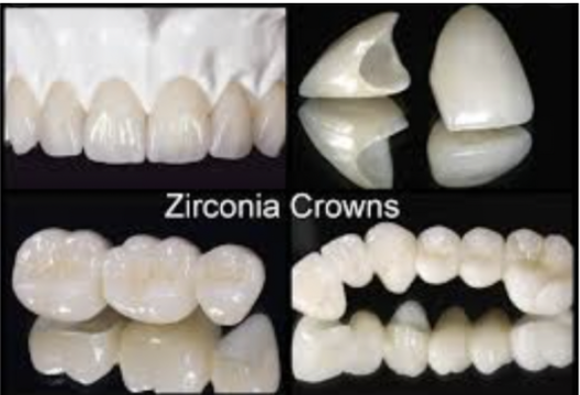 My TEETH Journey - treatment image