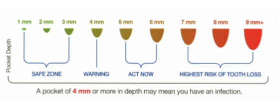 My TEETH Journey - treatment image