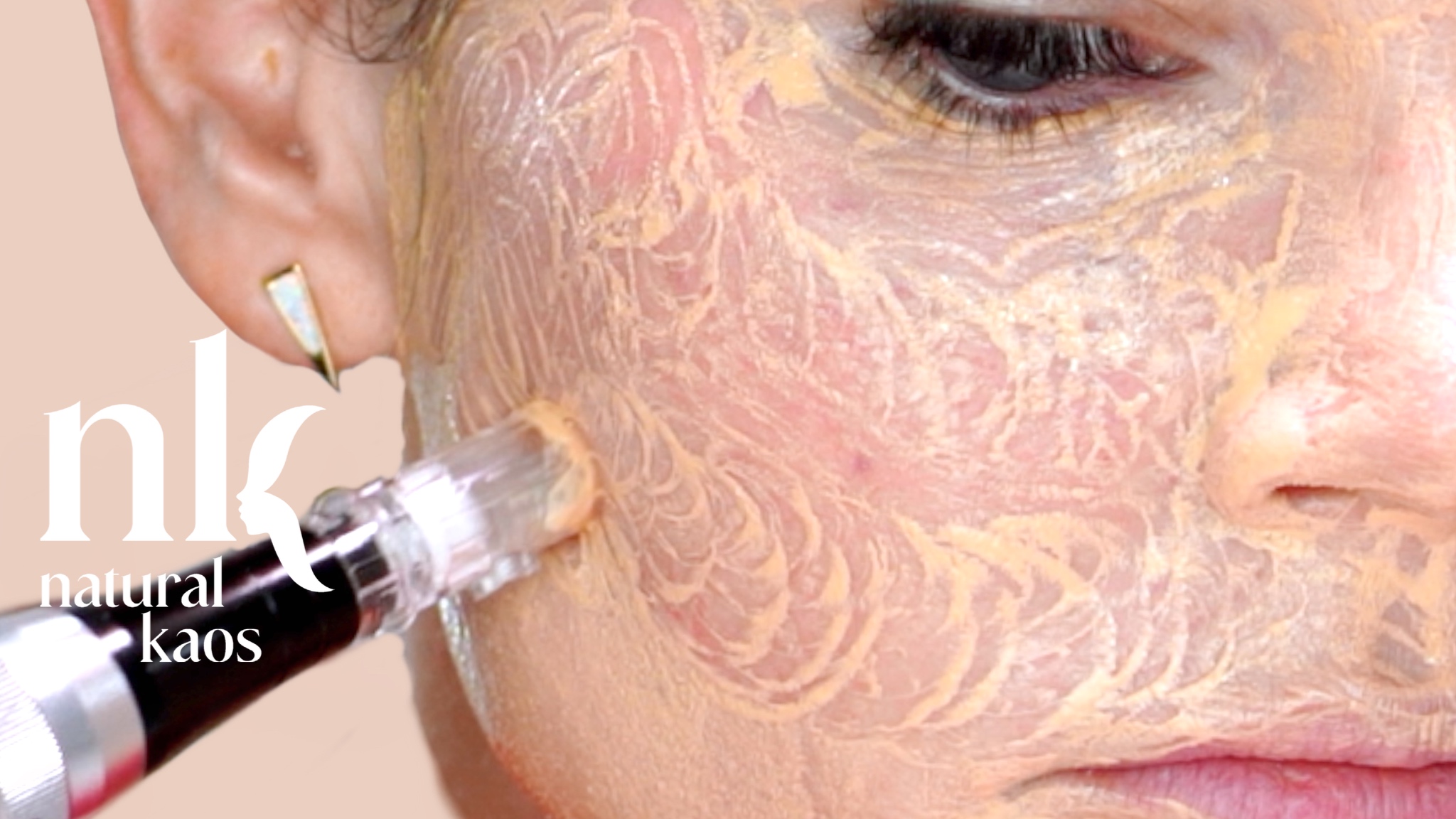 BB Glow Experience Covering Meso Bruises