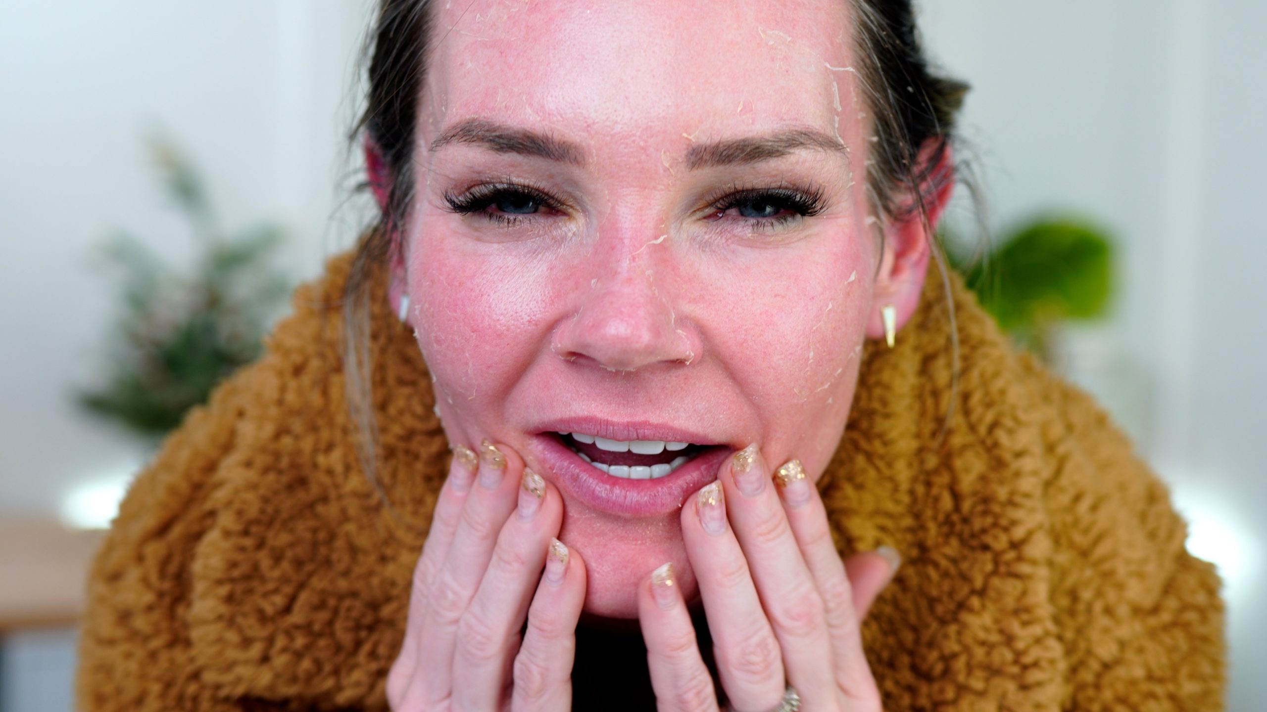 Miracle Acid Peel