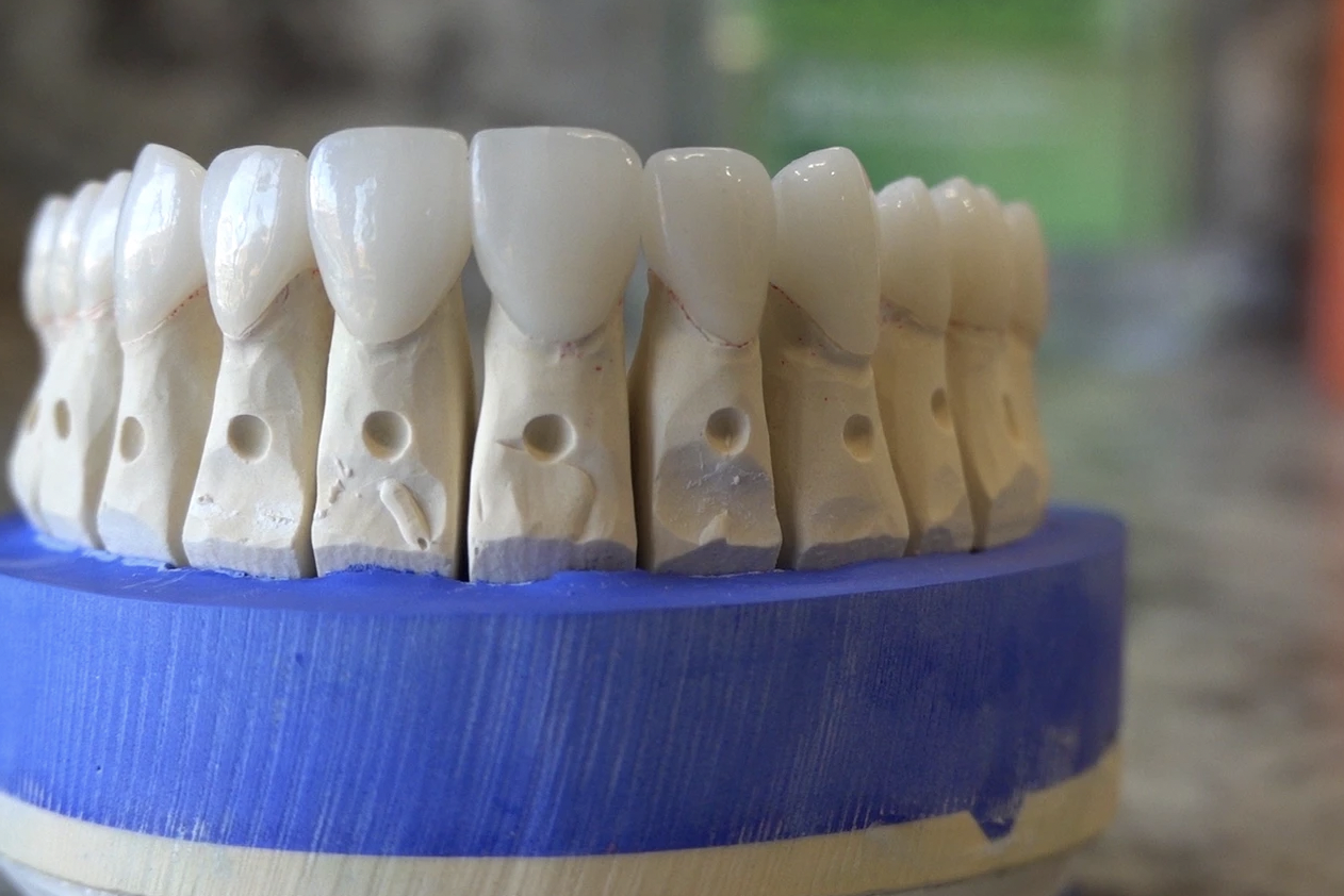 My TEETH Journey