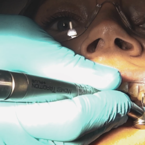 My TEETH Journey - treatment image