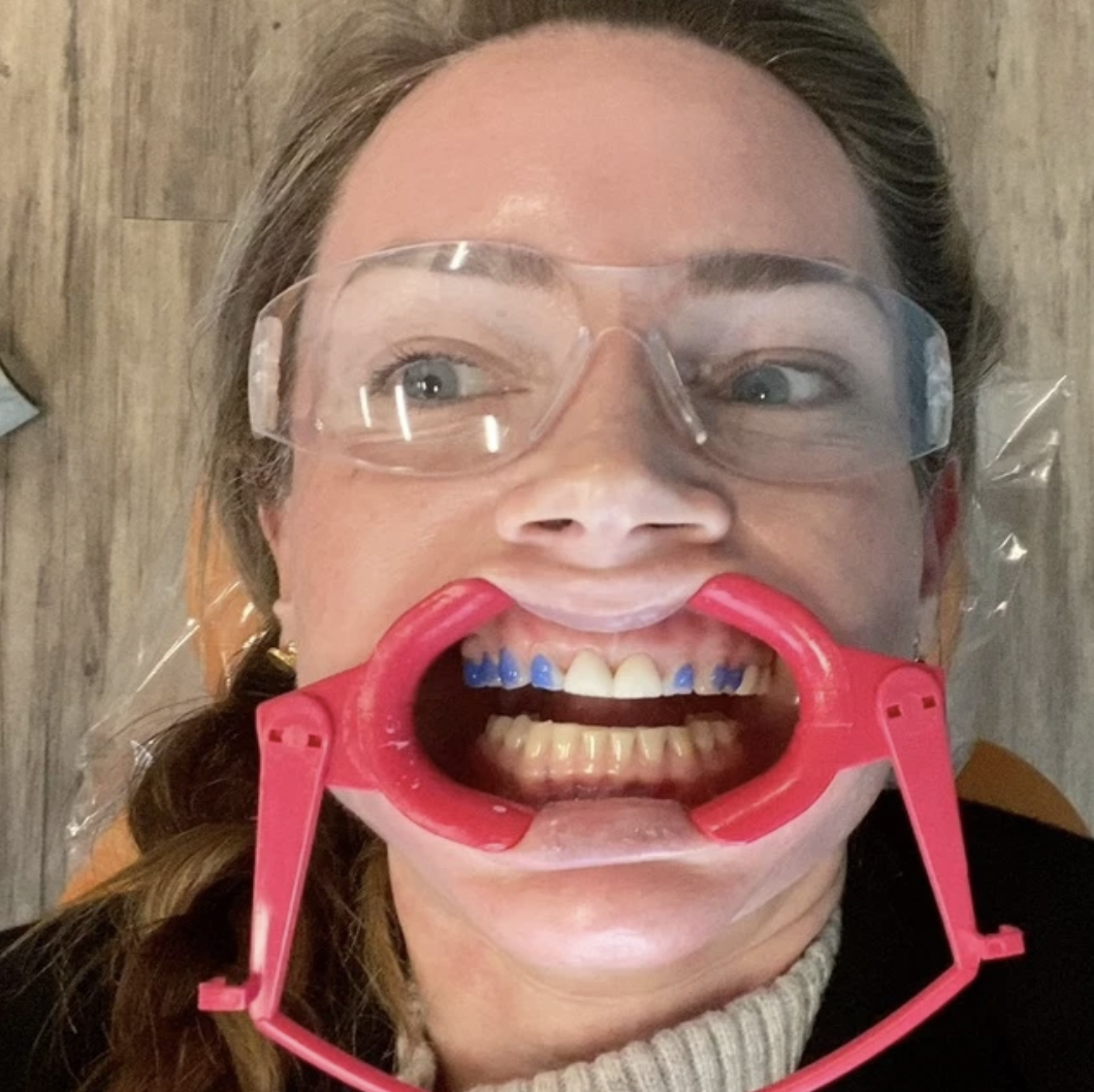My TEETH Journey - treatment image