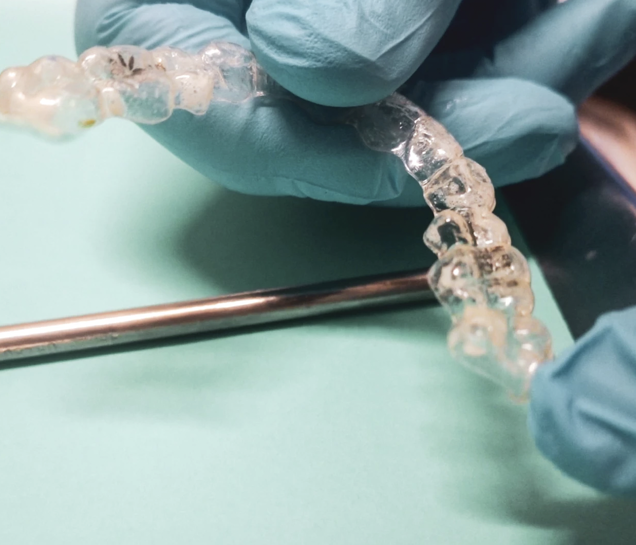 My TEETH Journey - treatment image