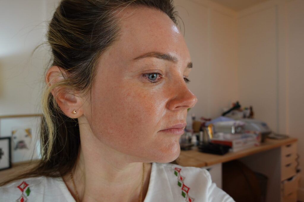 Microneedling at Home Session #6