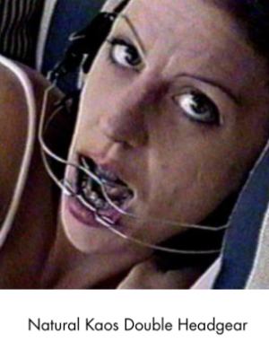 teeth headgear