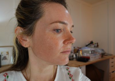 Microneedling at Home Session #6