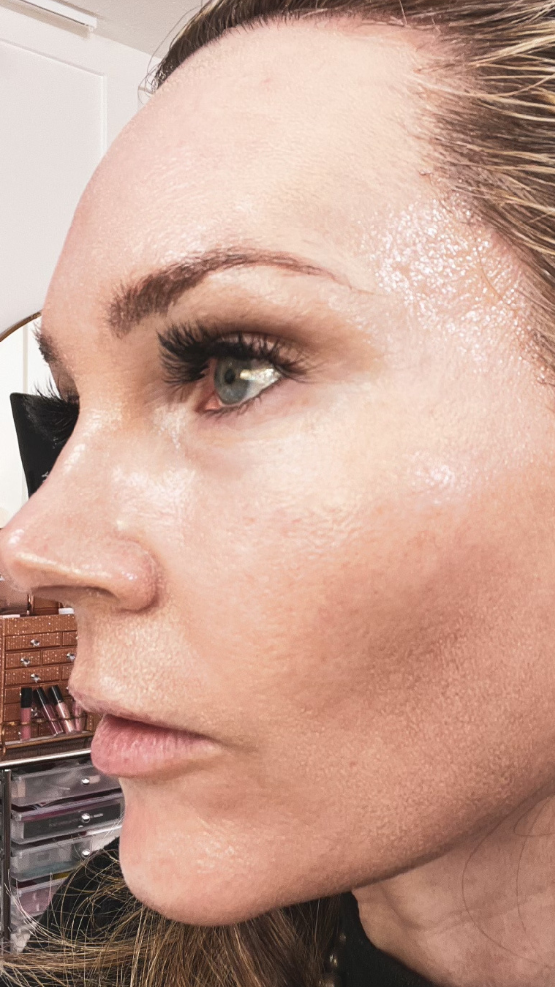 INNOTOX Facial and BB GLOW - treatment image