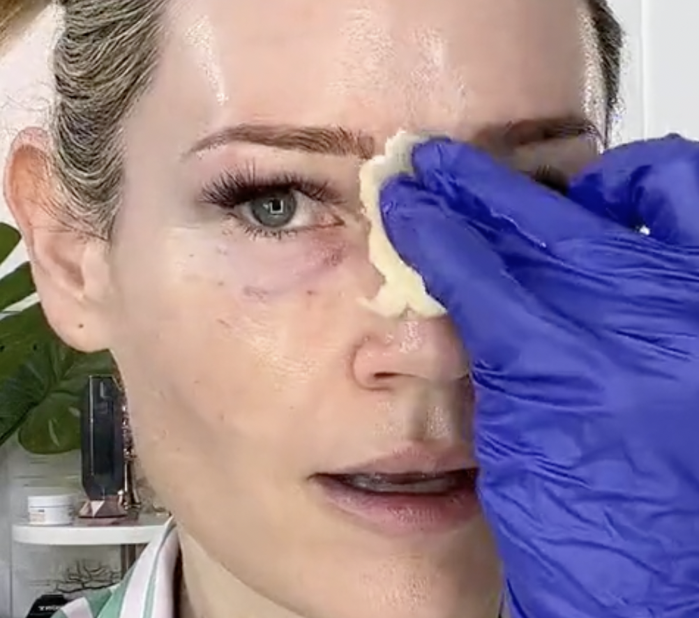 Fade Peel from Makeup Artists Choice