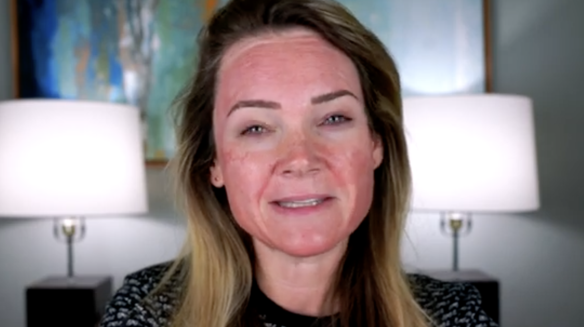 From TCA Peel Beginner to Pro: My Journey & Updated Routine BELOW