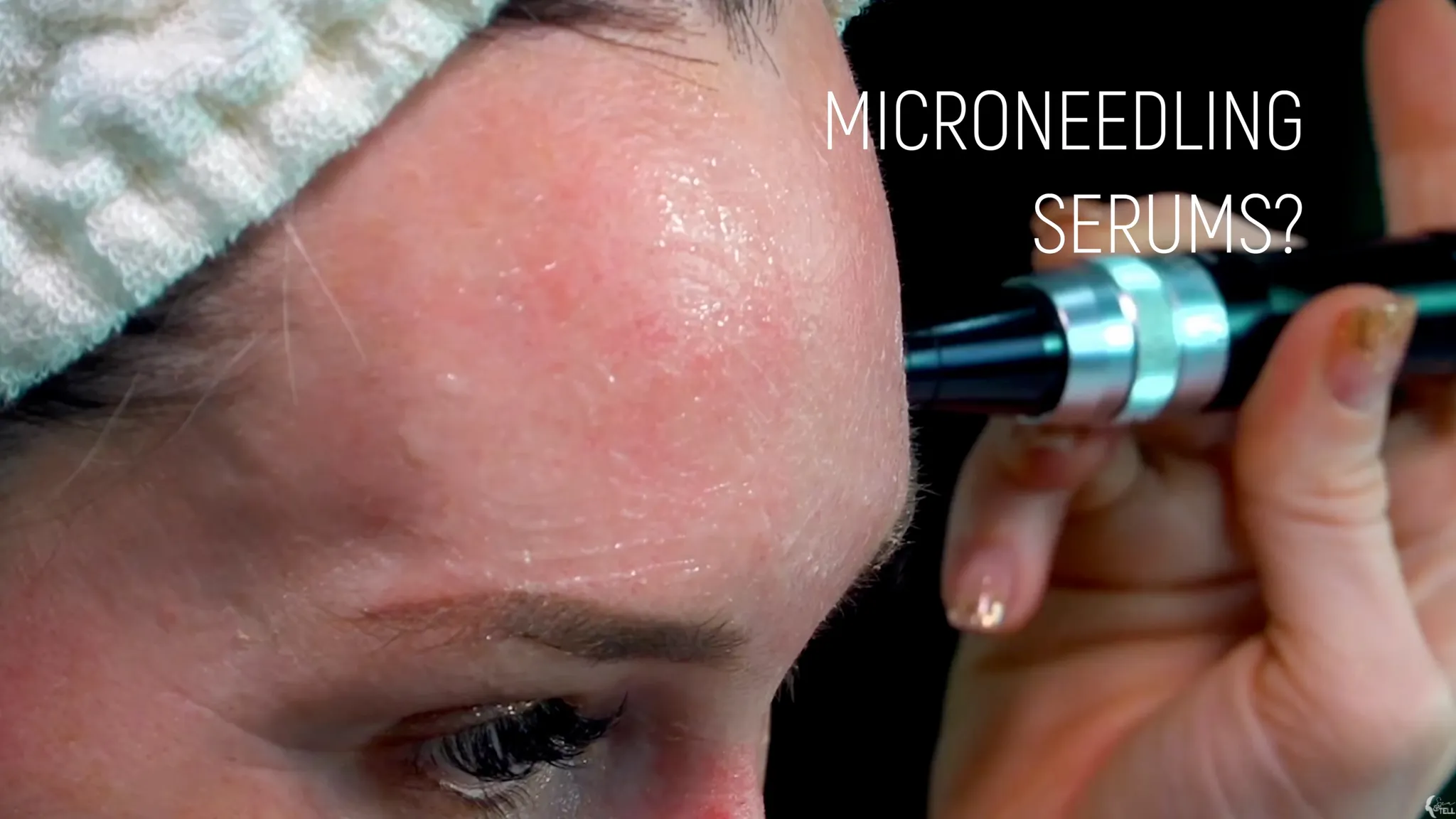 Top 5 Affordable Serums for Microneedling 2025 | Countdown + Expert Tips
