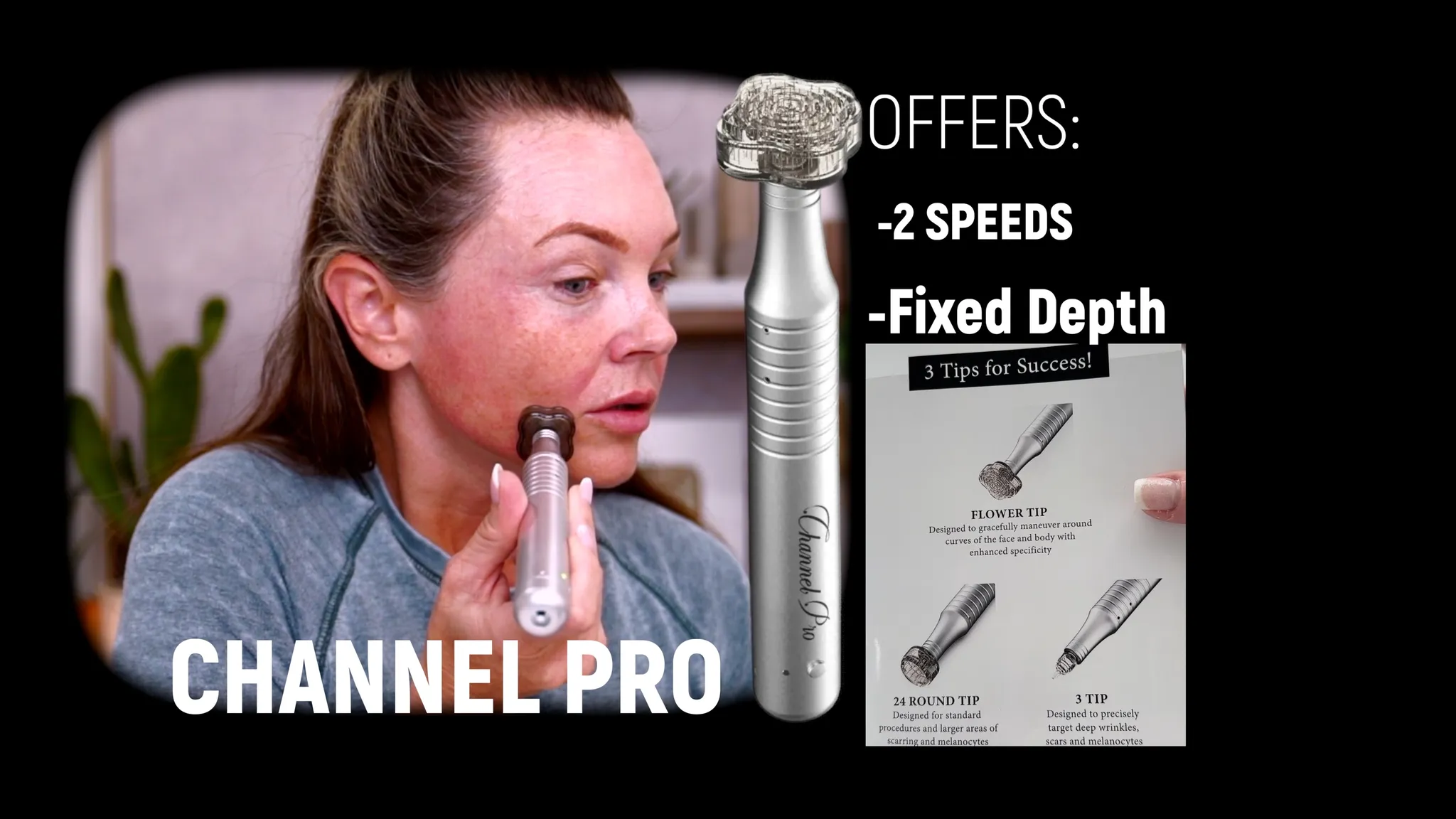 Tox + Exosome Microchanneling Facial with the Channel Pro Pen - treatment image