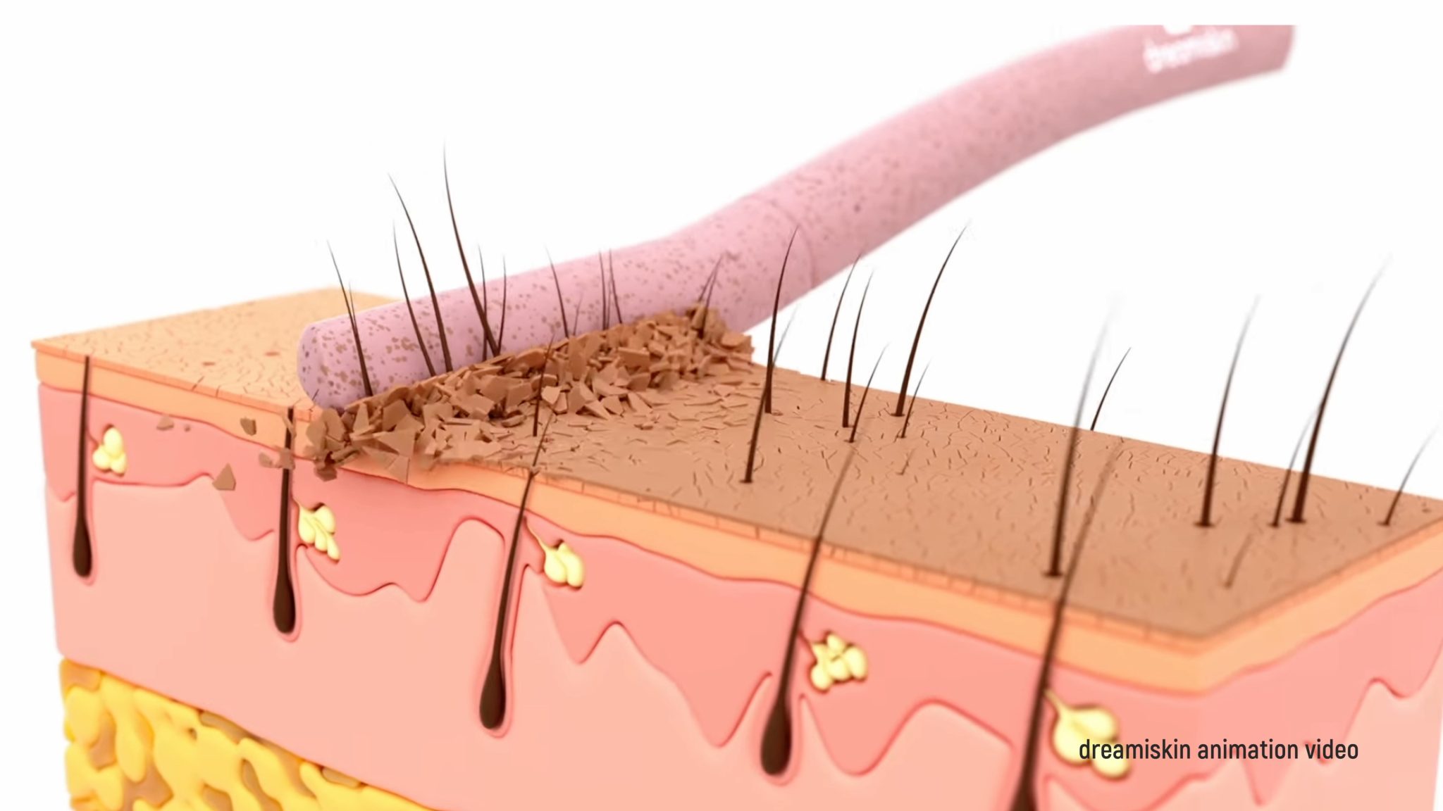 3rd Soonsu Shining Peel Demo for Glowing Summer Skin - treatment image