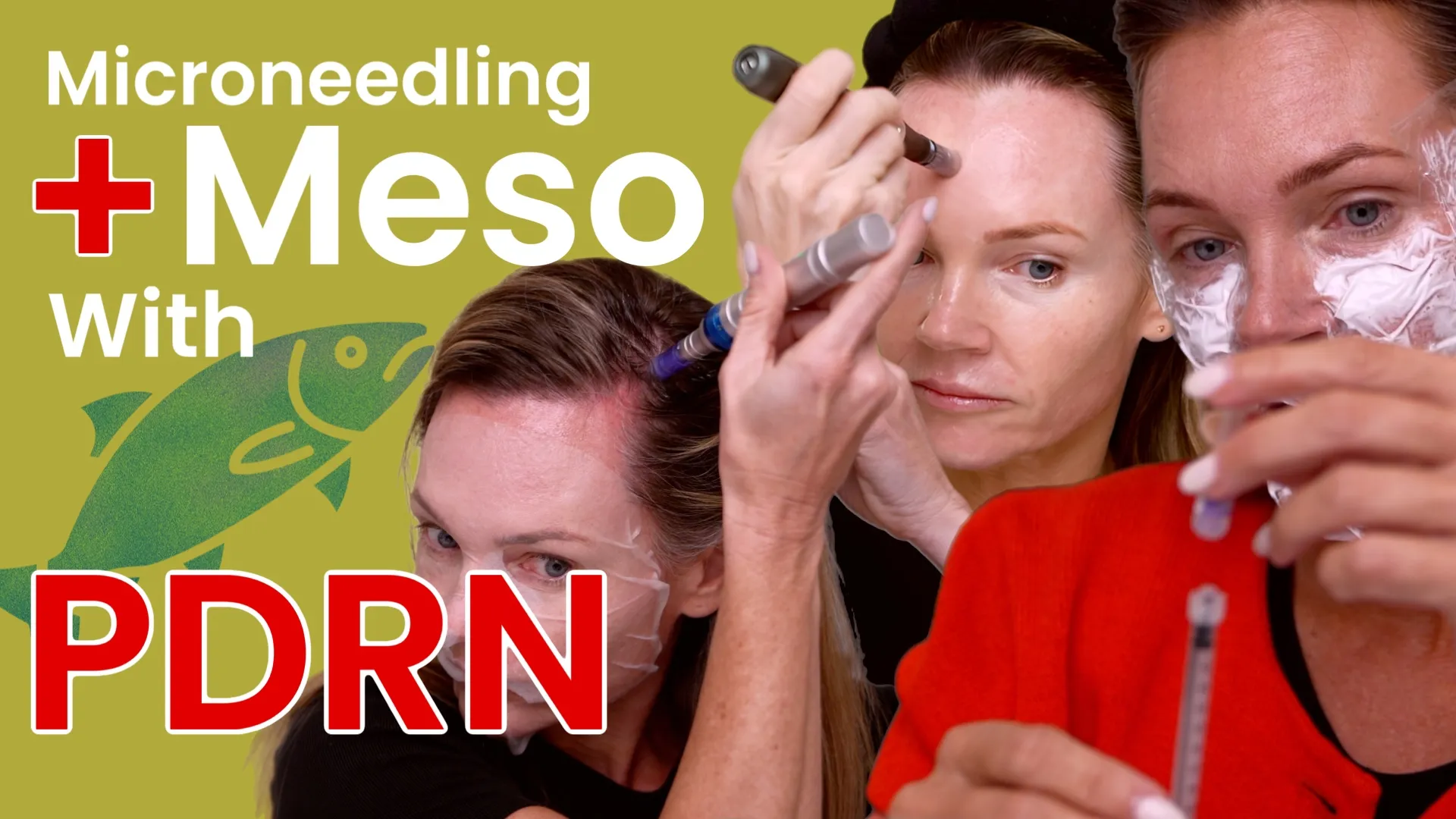Microneedling vs Mesotherapy: Curenex PDRN Glow Booster Explained