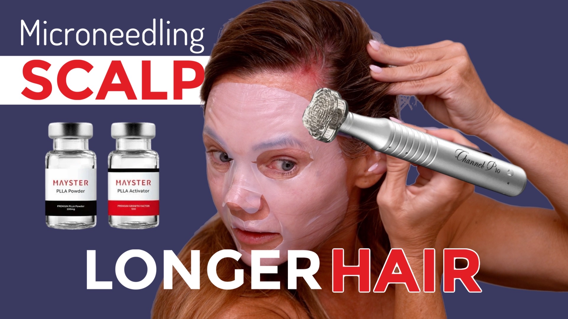 Scalp Microneedling with Mayster PLLA Booster