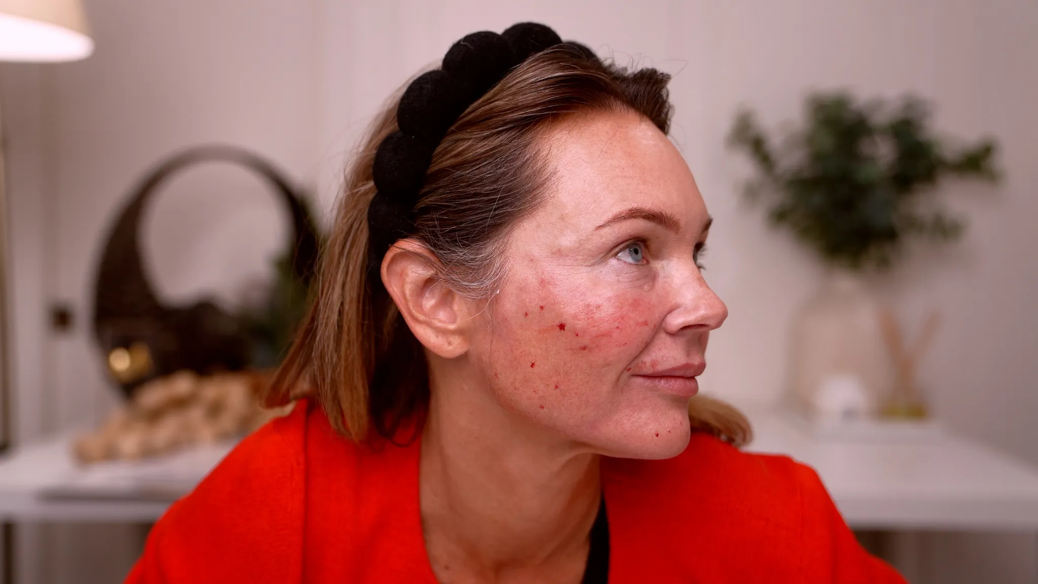 Microneedling vs Mesotherapy: Curenex PDRN Glow Booster Explained - treatment image