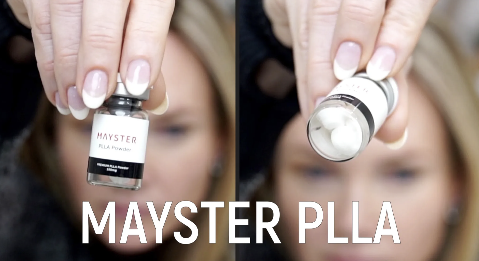 Scalp Microneedling with Mayster PLLA Booster - treatment image