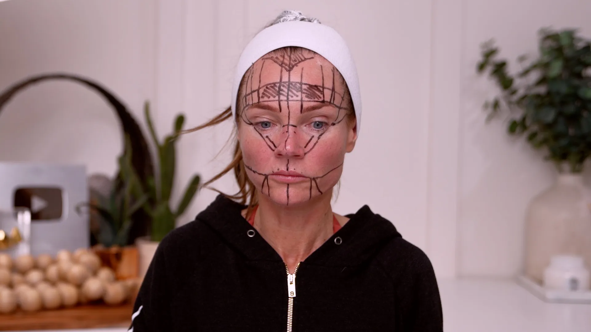 Face & Neck Map 200-UnitS Of Korean Toxin Dehantox - treatment image