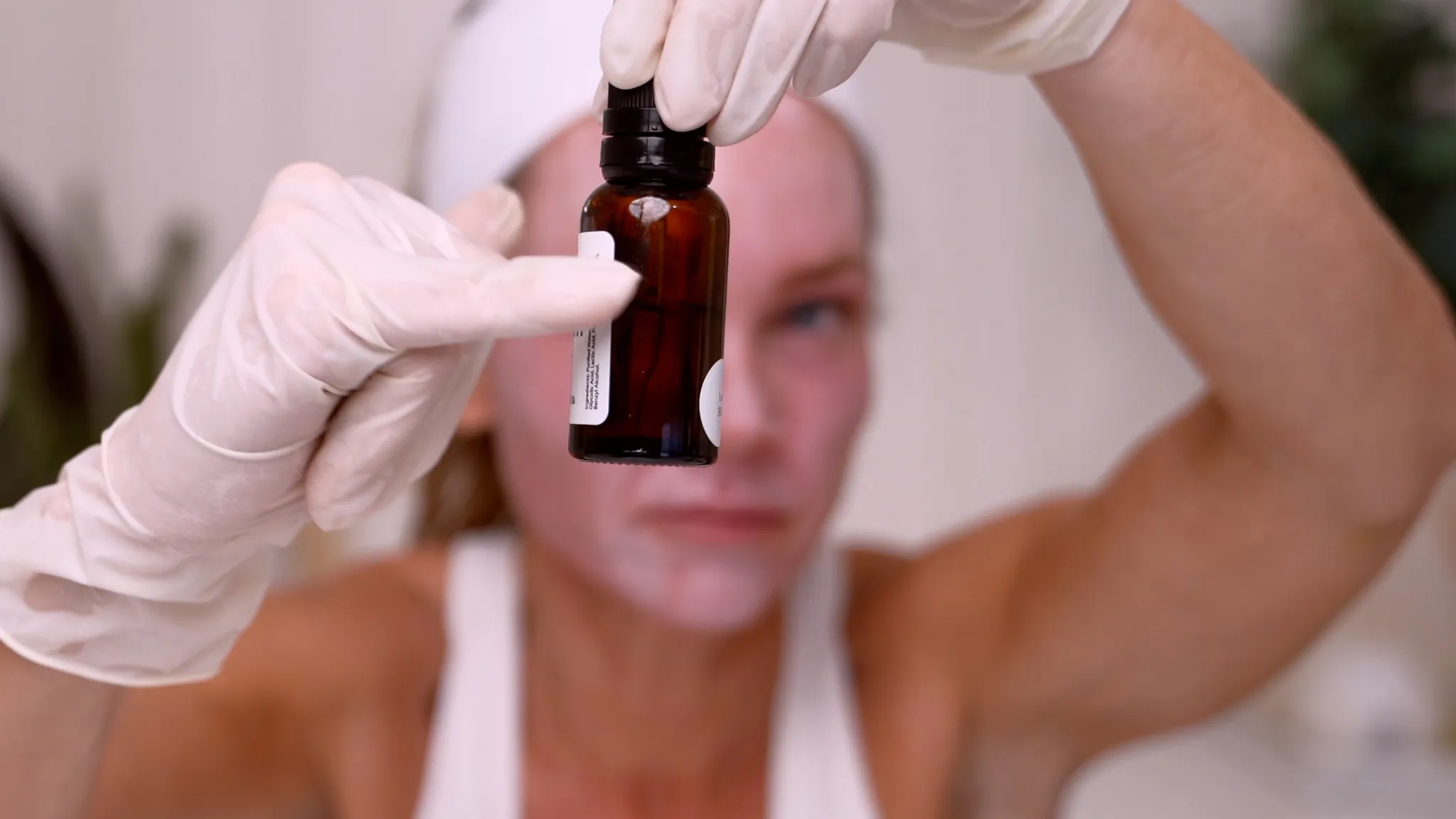 DIY 30% TCA Peel at Home (Full Demo + Recovery)