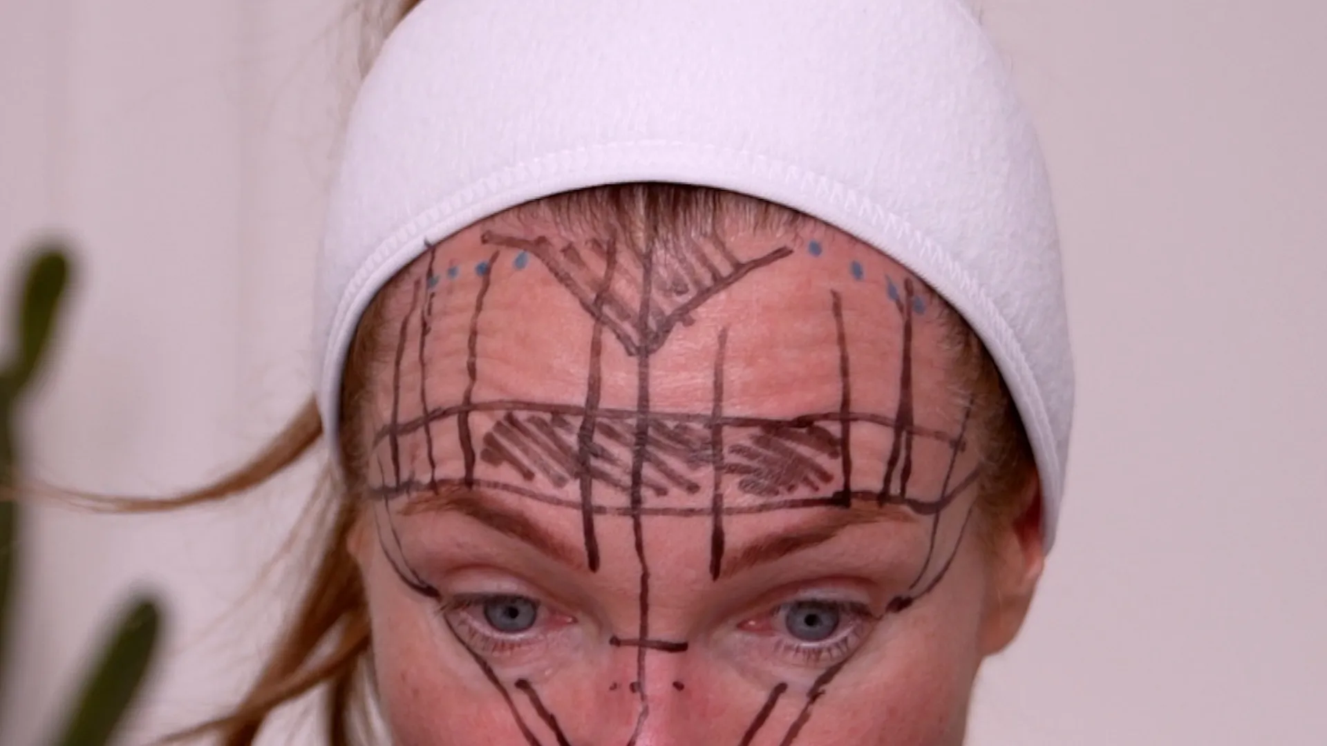 Face & Neck Map 200-UnitS Of Korean Toxin Dehantox - treatment image