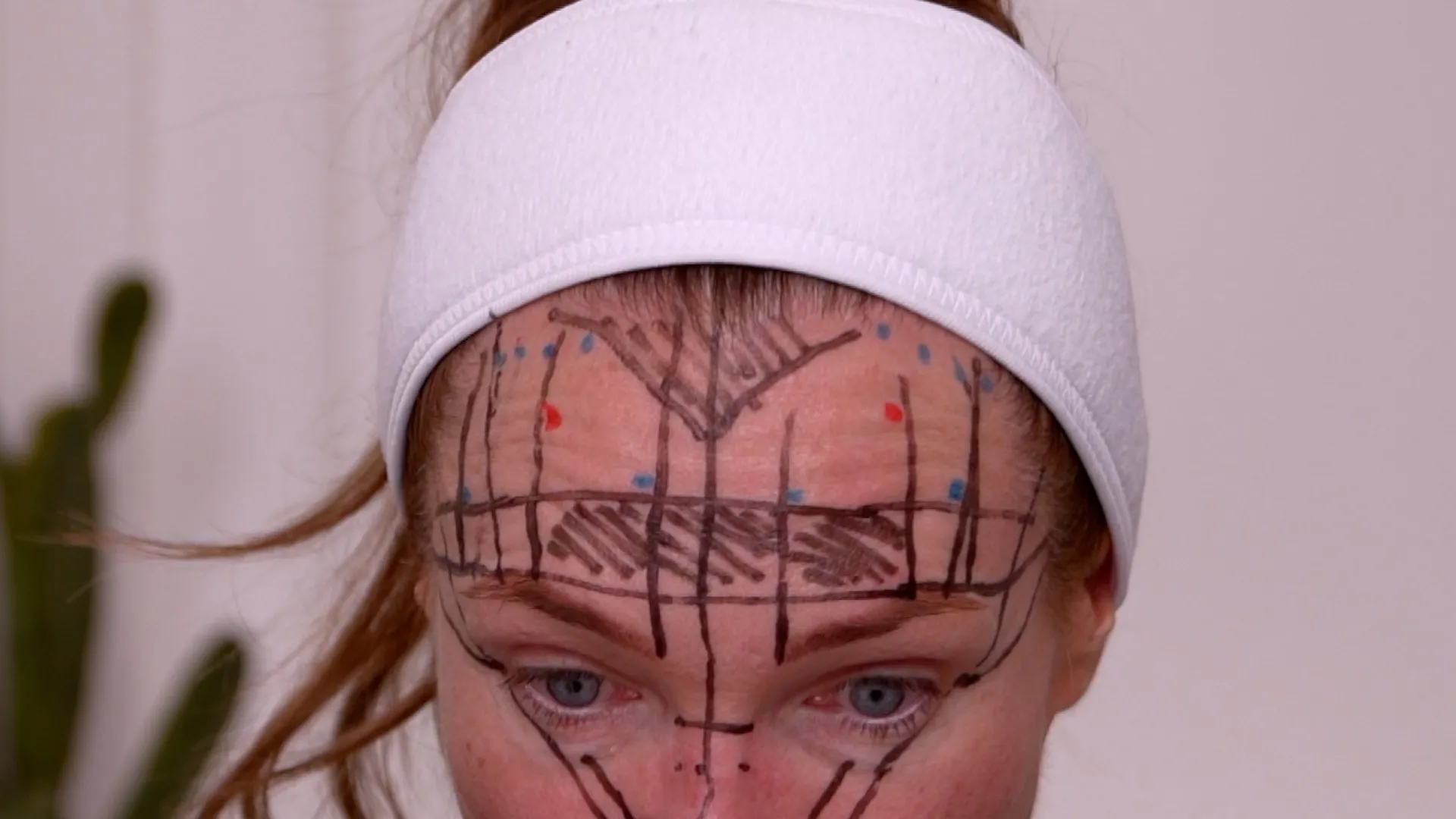 Face & Neck Map 200-UnitS Of Korean Toxin Dehantox - treatment image