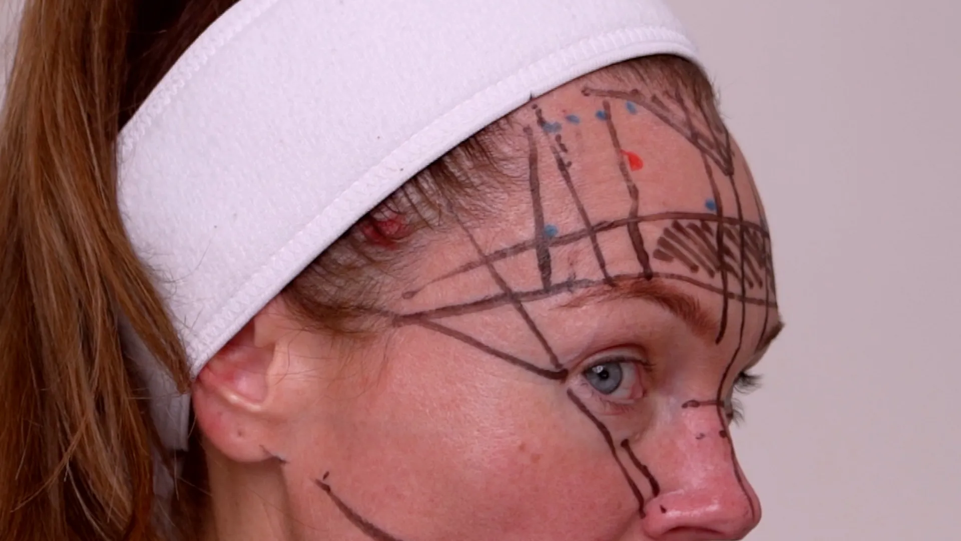 Face & Neck Map 200-UnitS Of Korean Toxin Dehantox - treatment image