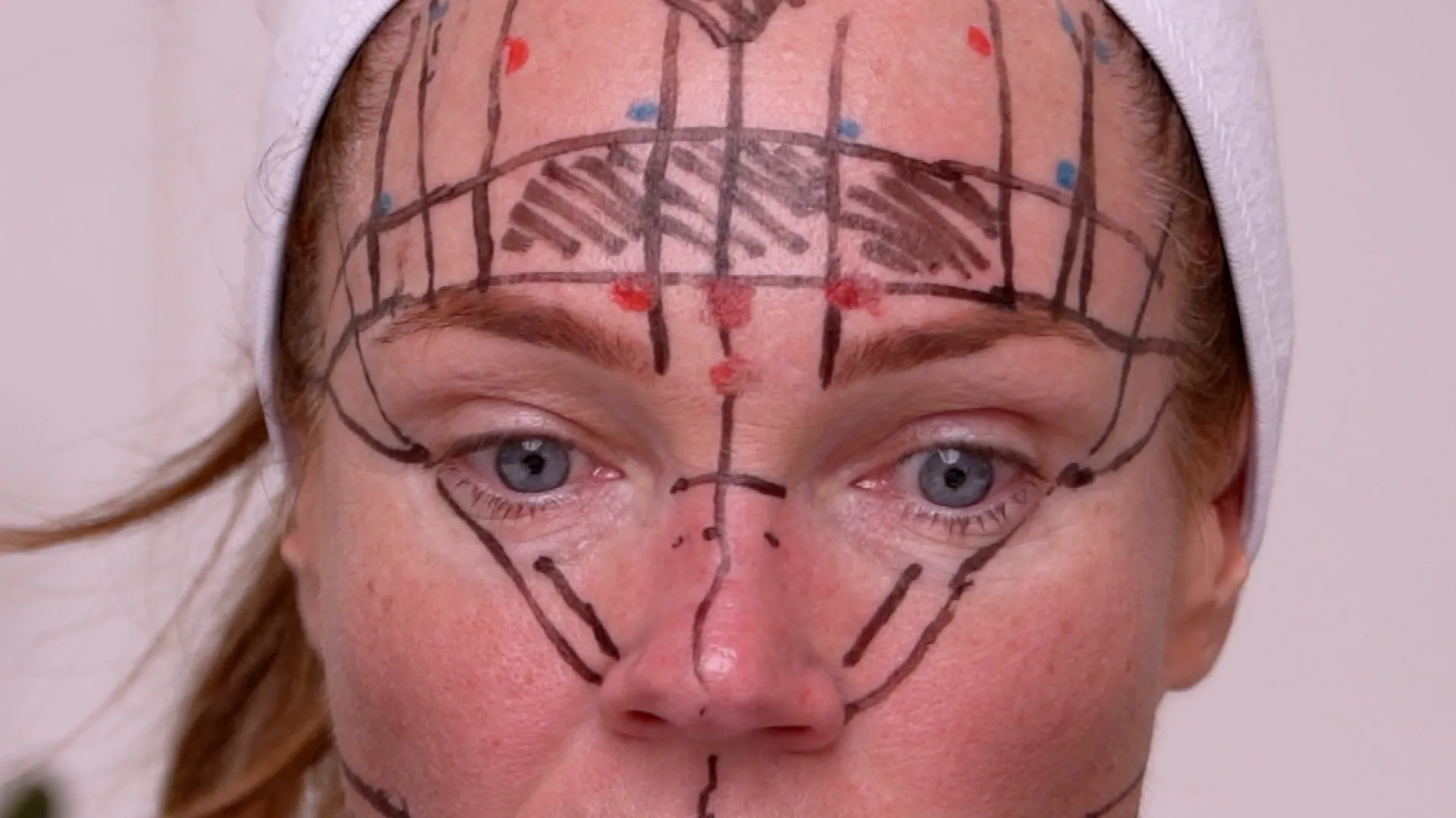 Face & Neck Map 200-UnitS Of Korean Toxin Dehantox - treatment image