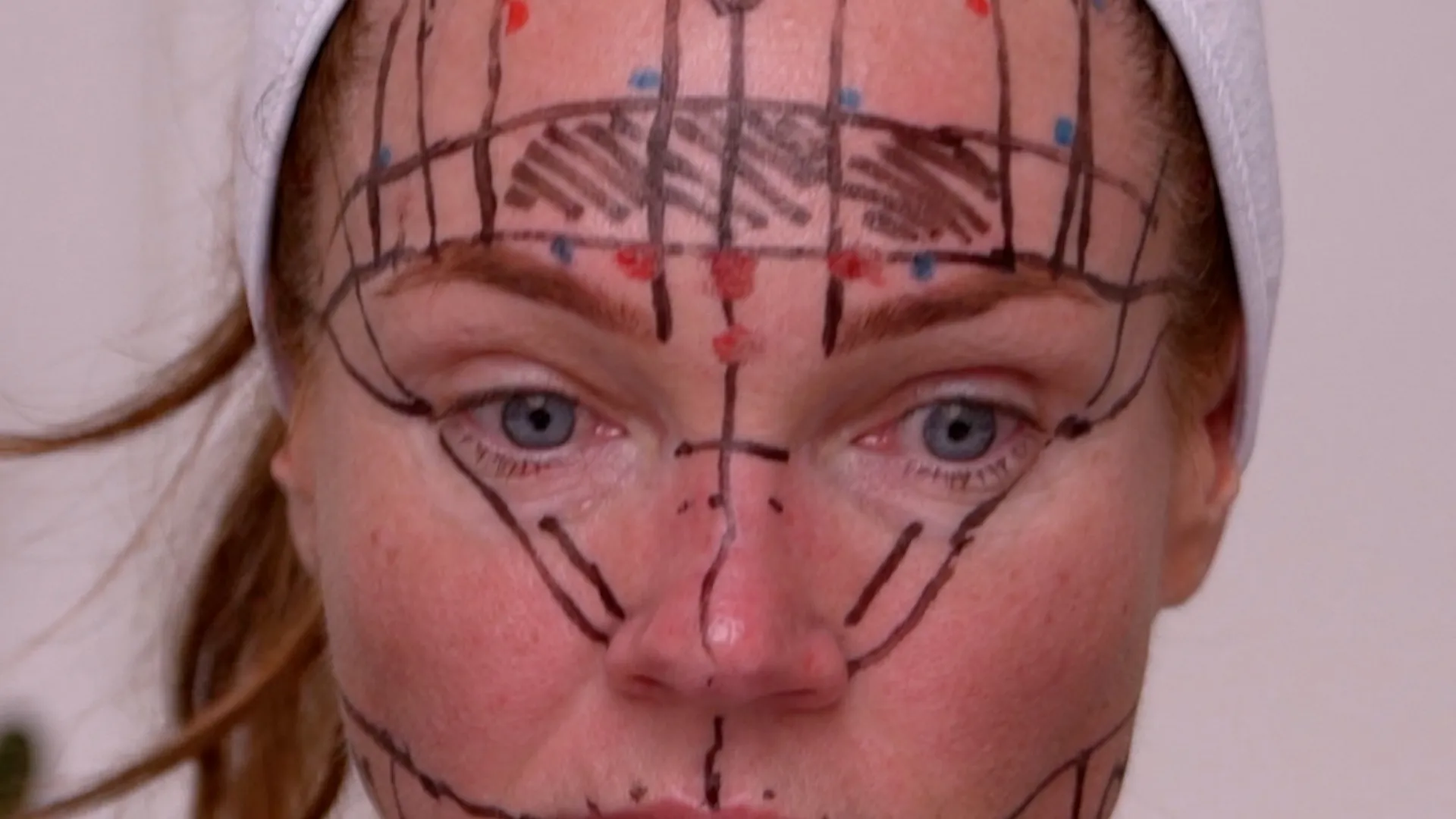 Face & Neck Map 200-UnitS Of Korean Toxin Dehantox - treatment image