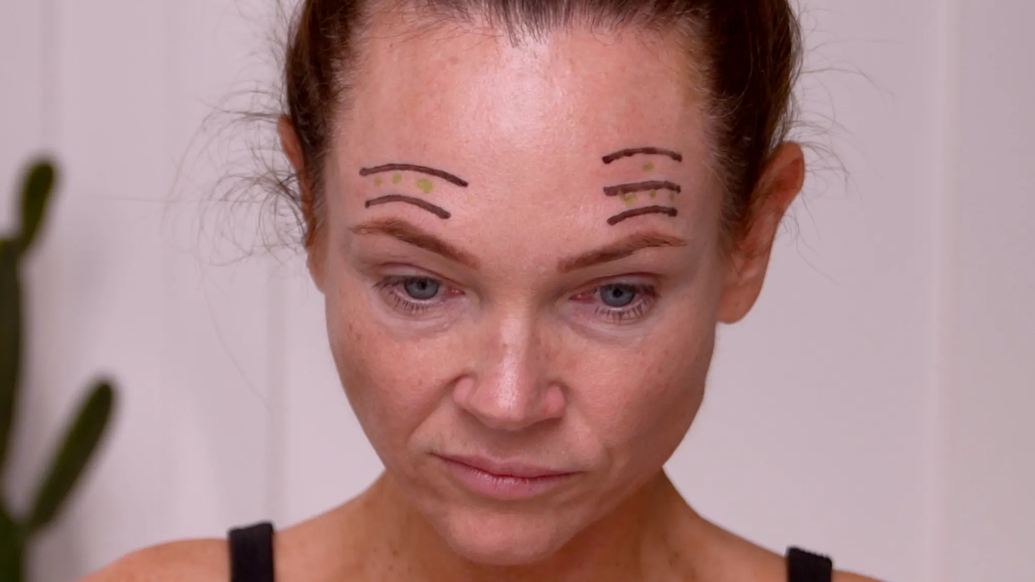 Dehantox 100U Mapping Update: Best Practices for Touch-Up Treatments - treatment image